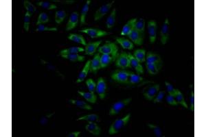 Immunofluorescence staining of Hela Cells with ABIN7127468 at 1:50, counter-stained with DAPI. (Recombinant EIF4A1 抗体)