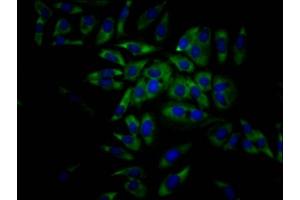 Immunofluorescence staining of Hela Cells with ABIN7127468 at 1:50, counter-stained with DAPI. (Recombinant EIF4A1 抗体)