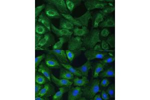 Immunofluorescence analysis of U-2 OS cells using EIF3G Polyclonal Antibody (ABIN1679693, ABIN3018723, ABIN3018724 and ABIN6220556) at dilution of 1:100 (40x lens). (EIF3G 抗体  (AA 1-320))
