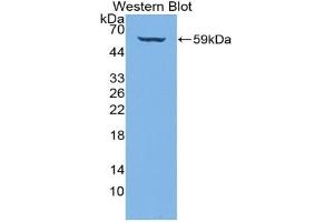 Detection of Recombinant COL4a3, Human using Polyclonal Antibody to Collagen Type IV Alpha 3 (COL4a3) (COL4a3 抗体  (AA 1428-1670))