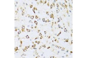 Immunohistochemistry of paraffin-embedded mouse brain using NRG4 antibody (ABIN3016309, ABIN3016310, ABIN3016311 and ABIN6219713) at dilution of 1:100 (40x lens). (Neuregulin 4 抗体  (AA 1-115))