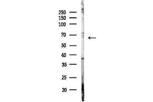 anti-F-Box and WD Repeat Domain Containing 11 (FBXW11) (C-Term) antibody