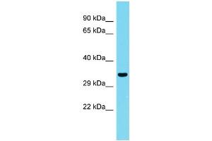 Host: Rabbit Target Name: CCDC75 Sample Type: Fetal Kidney lysates Antibody Dilution: 1. (CCDC75 抗体  (N-Term))