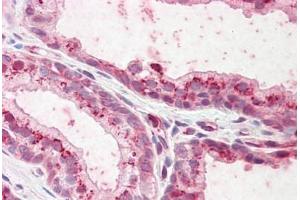 Human Prostate: Formalin-Fixed, Paraffin-Embedded (FFPE) (Plakophilin 2 抗体  (AA 125-139))