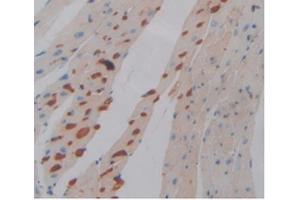 IHC-P analysis of Mouse Heart Tissue, with DAB staining. (PD-L1 抗体  (AA 48-290))