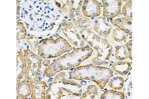 Immunohistochemistry of paraffin-embedded Rat kidney using SLC4A4 / NBC Polyclonal Antibody at dilution of 1:100 (40x lens). (SLC4A4 抗体)