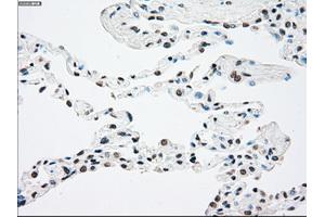 Immunohistochemistry (IHC) image for anti-Neurotrophic Tyrosine Kinase, Receptor, Type 2 (NTRK2) antibody (ABIN2734330)