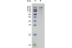 SDS-PAGE (SDS) image for Carcinoembryonic Antigen-Related Cell Adhesion Molecule 5 (CEACAM5) (AA 35-947) protein (His tag) (ABIN7491119)