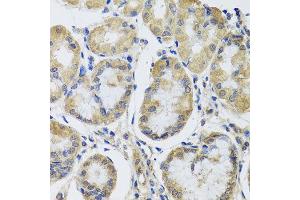 Immunohistochemistry of paraffin-embedded human gastric using MRPL1 antibody at dilution of 1:100 (x40 lens). (MRPL1 抗体)