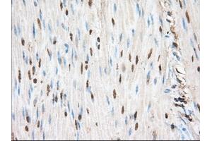 Immunohistochemical staining of paraffin-embedded Human liver tissue using anti-PIM2 mouse monoclonal antibody. (PIM2 抗体)