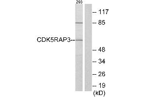 Western blot analysis of extracts from 293 cells, using CDK5RAP3 antibody. (CDK5RAP3 抗体)