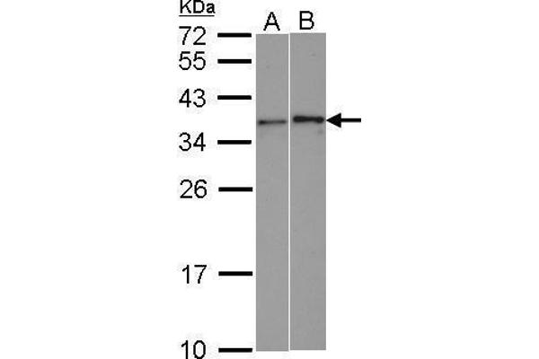 WBSCR22 抗体  (Center)