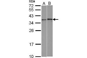 WB Image Sample (30 ug of whole cell lysate) A: HeLa B: HCT116 12% SDS PAGE antibody diluted at 1:1000 (WBSCR22 抗体  (Center))