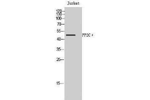 Western Blotting (WB) image for anti-Protein Phosphatase, Mg2+/Mn2+ Dependent, 1L (PPM1L) (Internal Region) antibody (ABIN3186533) (PPM1L 抗体  (Internal Region))