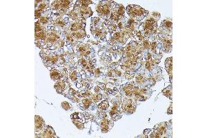 Immunohistochemistry of paraffin-embedded rat pancreas using PNLIPRP1 antibody (ABIN7269167) at dilution of 1:100 (40x lens).