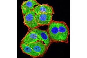 Immunofluorescence (IF) image for anti-B-Cell CLL/lymphoma 11B (Zinc Finger Protein) (BCL11B) (AA 1-150) antibody (ABIN5611301)