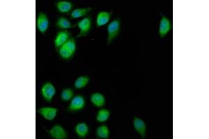 Immunofluorescence (IF) image for anti-Extended Synaptotagmin 2 (ESYT2) (AA 567-736) antibody (ABIN7152326)