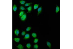 Immunofluorescence staining of A549 cells with ABIN7152326 at 1:200, counter-stained with DAPI. (FAM62B 抗体  (AA 567-736))