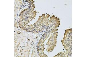 Immunohistochemistry of paraffin-embedded human prostate using PTCD3 antibody. (PTCD3 抗体  (AA 450-689))