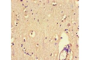 Immunohistochemistry of paraffin-embedded human brain tissue using ABIN7167518 at dilution of 1:100 (PTPRS 抗体  (AA 25-128))