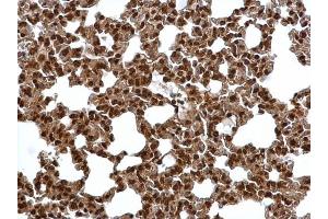 IHC-P Image Proteasome 20S alpha 6 antibody detects Proteasome 20S alpha 6 protein at cytosol and nucleus on mouse lung by immunohistochemical analysis. (PSMA6 抗体  (Center))