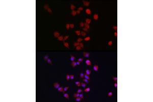 Immunofluorescence analysis of A-549 cells using  antibody (ABIN7265580) at dilution of 1:300. (ANAPC11 抗体  (AA 1-84))