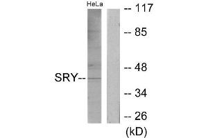 Western Blotting (WB) image for anti-Sex Determining Region Y (SRY) (Internal Region) antibody (ABIN1849548) (SRY 抗体  (Internal Region))