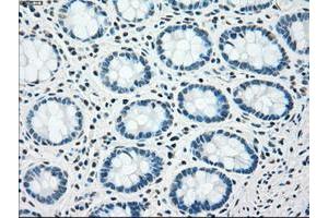 Image no. 4 for anti-Checkpoint Kinase 2 (CHEK2) antibody (ABIN1497498) (CHEK2 抗体)