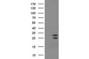 Western Blotting (WB) image for anti-Nonhomologous End-Joining Factor 1 (NHEJ1) antibody (ABIN1499730) (NHEJ1 抗体)