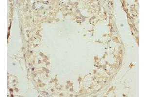 Immunohistochemistry of paraffin-embedded human testis tissue using ABIN7164276 at dilution of 1:100 (PRICKLE2 抗体  (AA 615-844))