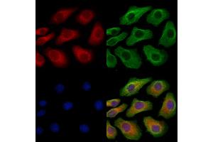 ABIN6265478 and ABIN6279868 staining Hela cells by IF/ICC. (TBC1D2 抗体  (N-Term))