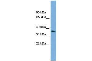 WB Suggested Anti-GNB4 Antibody Titration: 0. (GNB4 抗体  (Middle Region))