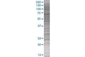 IL6 transfected lysate (IL6 293T Cell Transient Overexpression Lysate(Denatured))