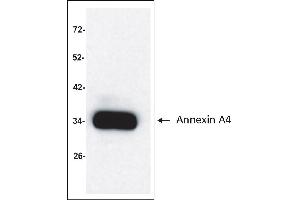Antigen: Colo 205 cells lysate (Total protein per lane: 15 µg)  Primary Antibody: Anti-ANXA4 monoclonal (PA351-29. (Annexin IV 抗体)