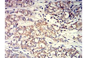 Immunohistochemistry (IHC) image for anti-ARP3 Actin-Related Protein 3 (ACTR3) (AA 287-418) antibody (ABIN5611287)