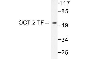 Image no. 1 for anti-POU domain, class 2, transcription factor 2 (POU2F2) antibody (ABIN271754) (Oct-2 抗体)
