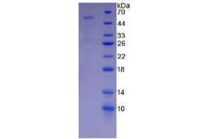 SDS-PAGE analysis of Mouse PAPPA Protein. (PAPPA 蛋白)