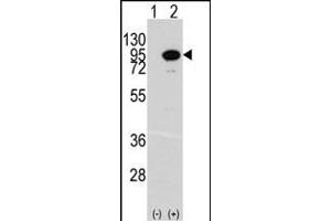 Western blot analysis of ACO2 (arrow) using rabbit polyclonal ACO2 Antibody (Center) (ABIN391809 and ABIN2841660). (ACO2 抗体  (AA 294-325))