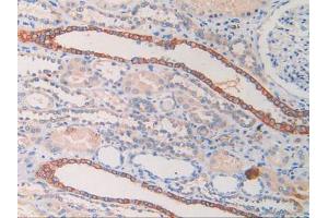 DAB staining on IHC-P; Samples: Human Kidney Tissue. (CYFRA21.1 抗体  (AA 244-400))