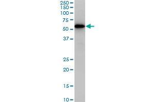 CDK8 monoclonal antibody (M02), clone 6E5. (CDK8 抗体  (AA 375-464))