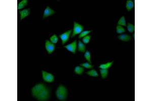 Immunofluorescence (IF) image for anti-Son of Sevenless Homolog 1 (SOS1) (AA 1140-1281) antibody (ABIN7170318)