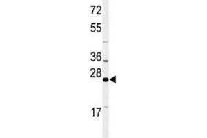 Western blot analysis of RAB27B antibody and NCI-H460 lysate. (RAB27B 抗体  (AA 186-215))