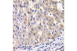 Immunohistochemistry of paraffin-embedded rat liver using RPL14 antibody (ABIN5974063) at dilution of 1/100 (40x lens). (RPL14 抗体)