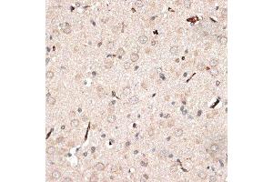 Immunohistochemistry of paraffin-embedded rat brain using KTN1 antibody.