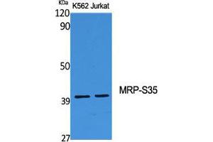 Western Blot (WB) analysis of specific cells using MRP-S35 Polyclonal Antibody. (MRPS35 抗体  (Internal Region))