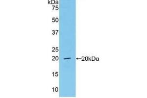 Detection of Recombinant vWF, Mouse using Polyclonal Antibody to Von Willebrand Factor (vWF) (VWF 抗体  (AA 1498-1665))