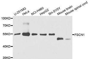 Western blot analysis of extracts of various cell lines, using FSCN1 antibody. (Fascin 抗体  (AA 394-493))