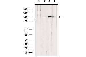 Western blot analysis of extracts from various samples, using NOD2 antibody. (NOD2 抗体  (N-Term))