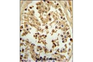 Formalin-fixed and paraffin-embedded human testis tissue reacted with EIF4E Antibody (ABIN650675 and ABIN2838634) , which was peroxidase-conjugated to the secondary antibody, followed by DAB staining. (EIF4E 抗体)
