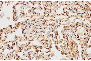 Immunohistochemistry of paraffin-embedded Human lung using IMP3 Polyclonal Antibody at dilution of 1:200 (IMP3 抗体)